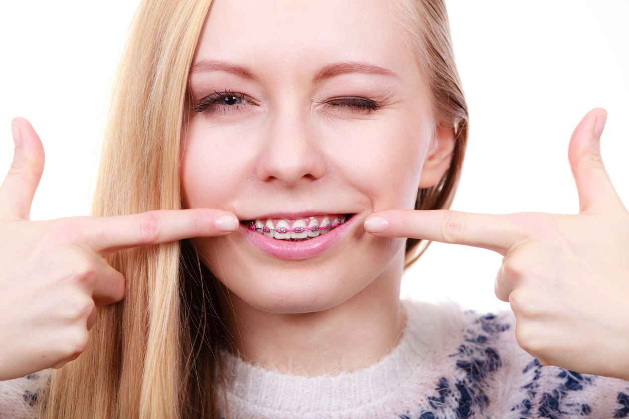 Orthodontie - Durée d'un traitement d'orthodontie 4